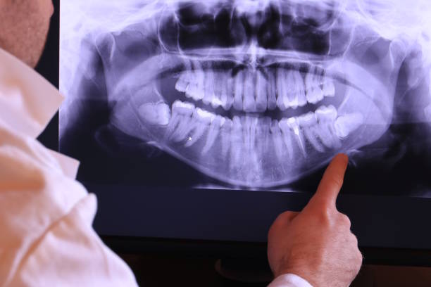 Best Emergency Treatment for Dental Infections or Abscesses in Northchase, NC